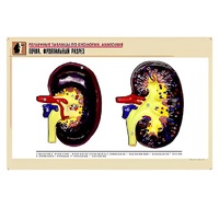 Рельефная таблица "Почка. Фронтальный разрез" (формат А1, матовое ламинир.) - «globural.ru» - Красноярск